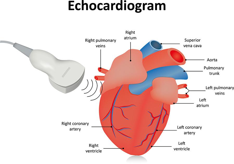 Echocardiography